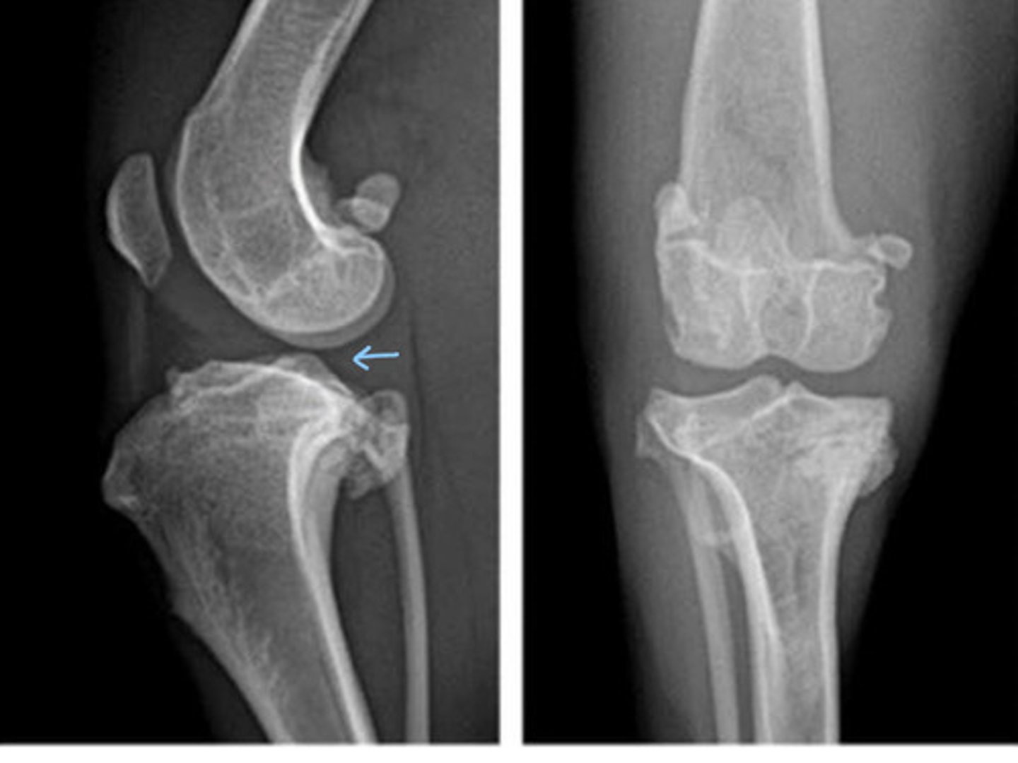 <p>What does this patient have?</p>