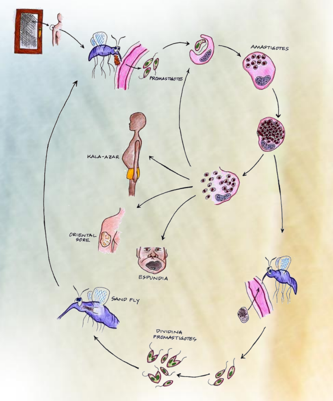 <p><strong>Leishmania.</strong></p><ul><li><p>complex life cycle, involving two main hosts, the sandfly vector and the mammalian host (ex. humans)</p></li></ul><ol><li><p><strong>begins when sandfly vector feeds on the blood of an infected mammal</strong>, it will ingest the amastigotes from it. </p></li><li><p><strong>These amastigotes will transform into promastigotes</strong> in the midgut of sandfly, and multiply by binary fission. These will <strong>then migrate to the sandfly`s salivary glands (pharynx of vector)</strong></p></li><li><p>During another blood meal, the<strong> sandfly will inoculate/inject the promastigotes into the skin</strong> of a new mammalian host, where they invade macrophages and<strong> transform back into amastigotes. </strong></p></li><li><p><strong>Inside the macrophages, they multiply by binary fission</strong> → rupture of the affected cell and subsequent infection of new macrophages. </p></li><li><p>The<strong> infection can cause agglomeration</strong> → spread to visceral organs, skin and mucosa.</p></li></ol><p></p>