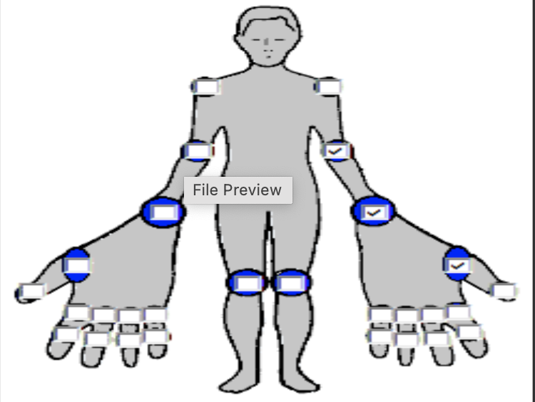 <p>feet: tarsals/metatarsals, ankle, hips</p>