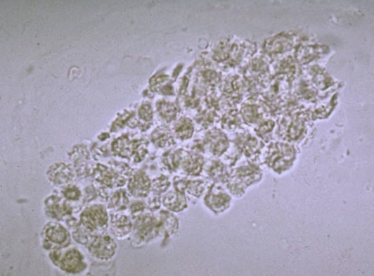 term image