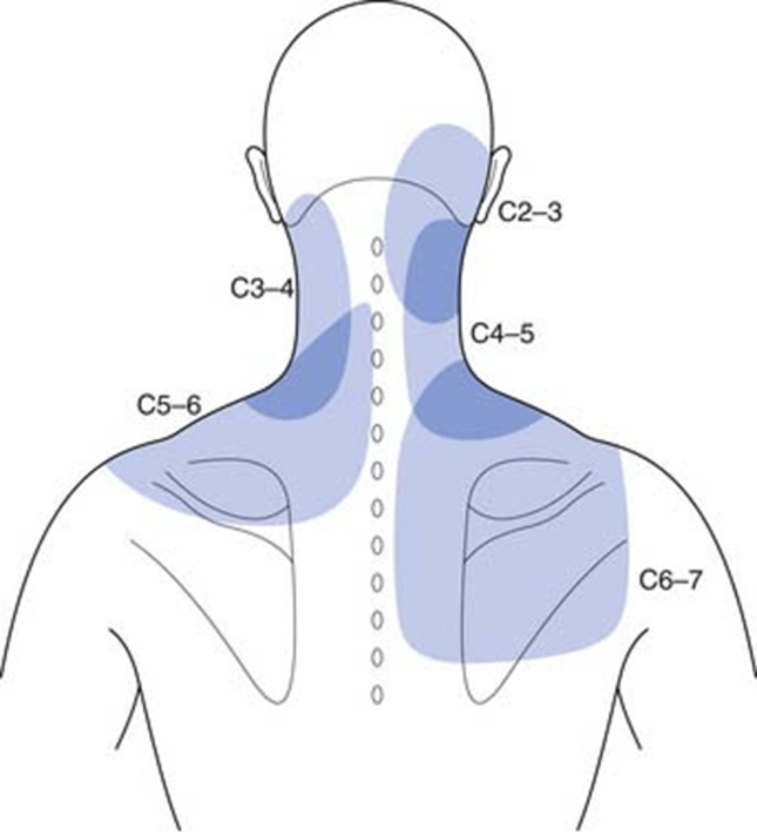 <p>- sharp, localized unilateral pain</p><p>- spasms</p><p>- referral into UE, but neck pain is always greater than referred locations</p>