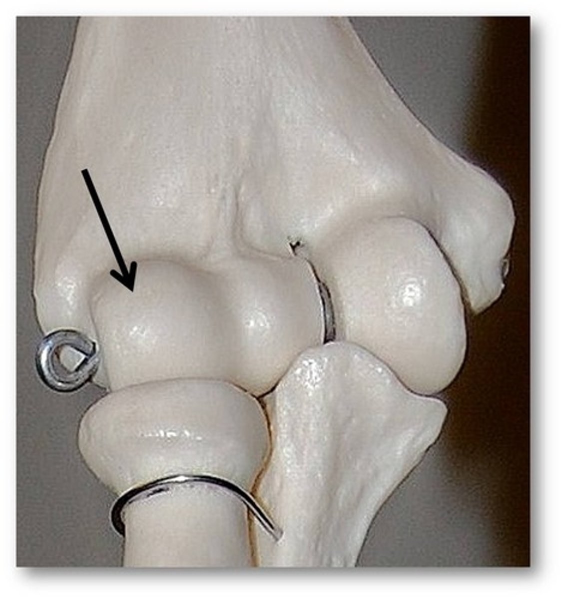 <p>Name the structure of the ulna</p>