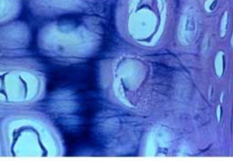 <p>Elastic (cartilage)</p>