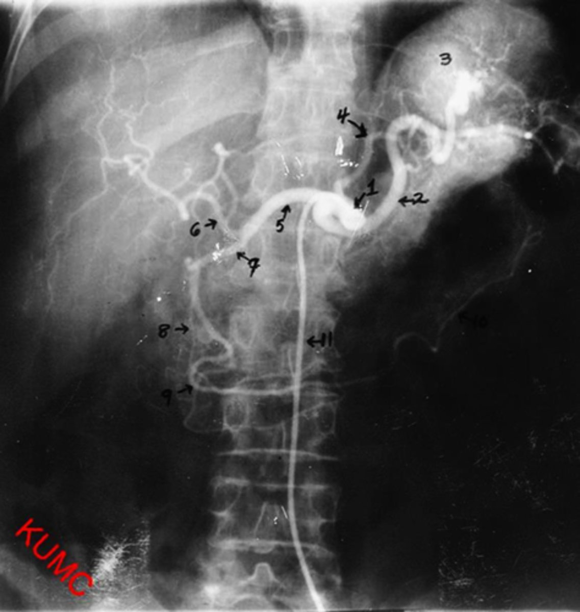 <p>1. Celiac Trunk 2. Splenic artery 3. Spleen 4. Left Gastric 5. Common Hepatic 6. Proper Hepatic 7. Gastroduodenal8. Pancreaticoduodenal (don't have to be able to identify for test!) 9. Right gastroepiploic 10. Left gastroepiploic</p>