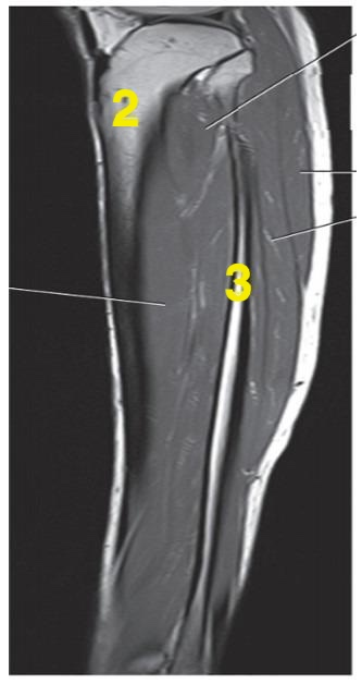 <p>What anatomy is # 3?</p>