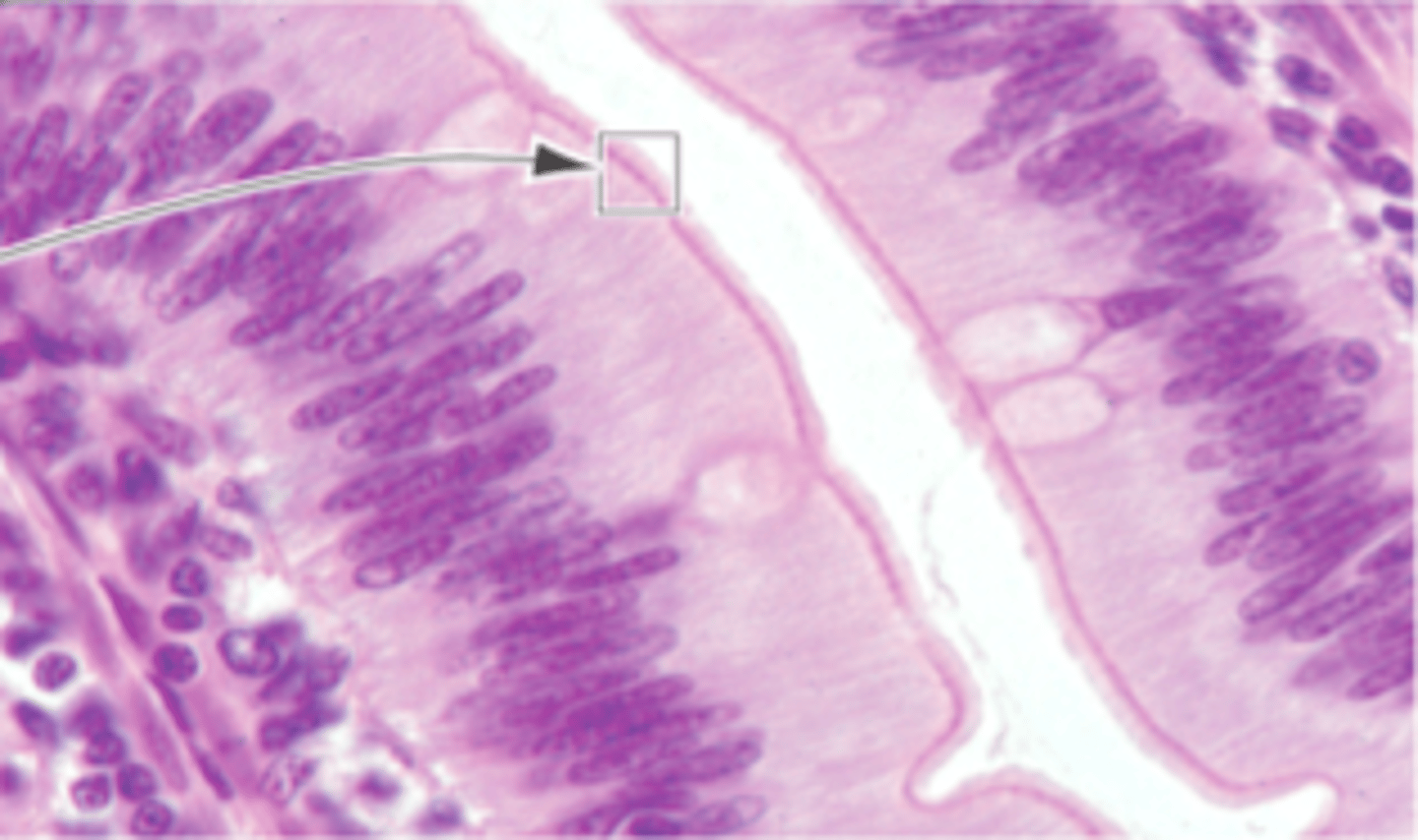 <p>Surface of a cell covered with microvilli. increases surface area of a cell for absorption</p>