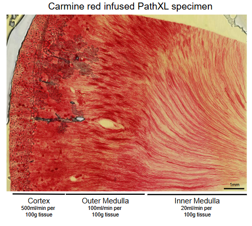 <p>Blood flow is reduced from fortex to inner medulla</p><ul><li><p>Prevents hyperosmolar gradent in medullary interstitium from being washed away.</p></li></ul><p></p>