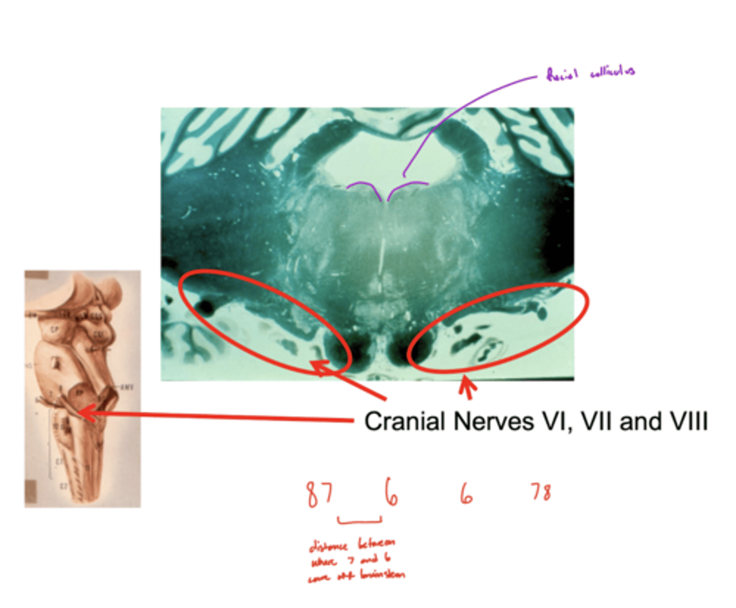 <p>8 &amp; 7 -- lateral and closer together</p><p>6 -- medial and far away</p><p>image -- look at red font</p>