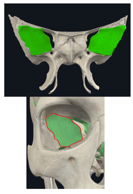 <p>Forma la parte externa de la cavidad orbitaria</p>