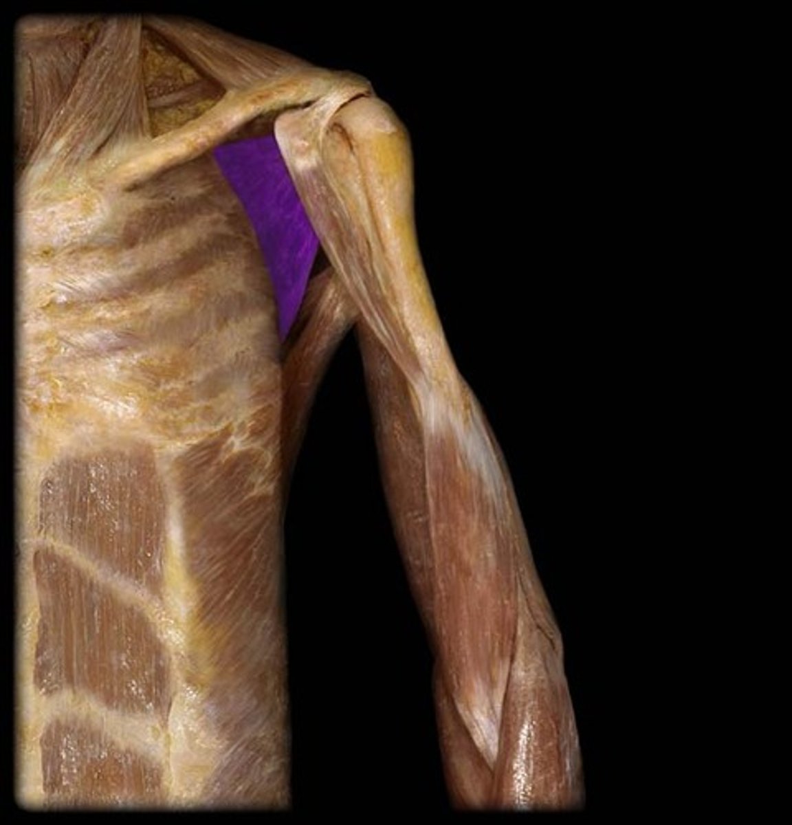 <p>What is this muscle, and what is its action, Proximal &amp; Distal insertions?</p>