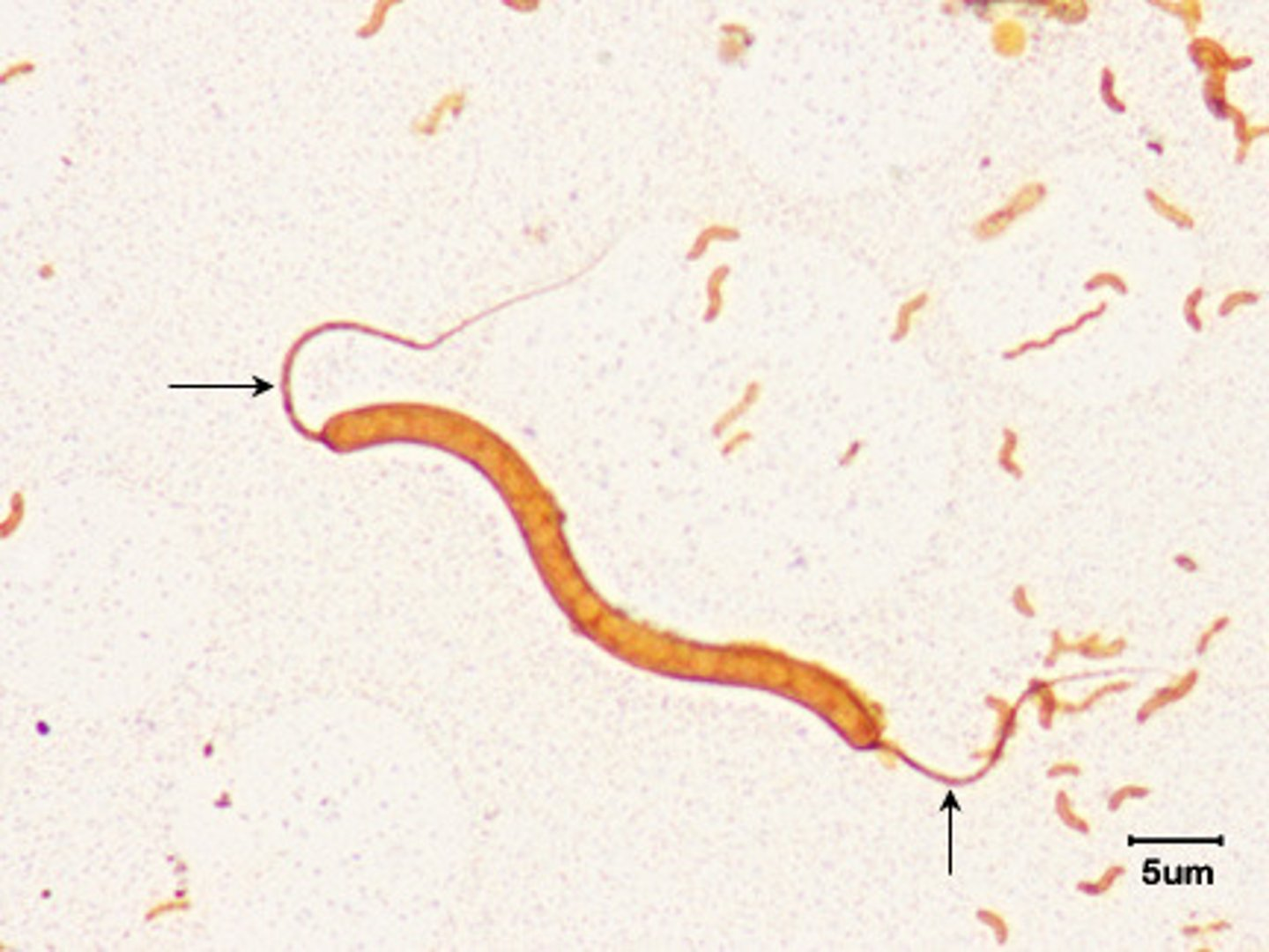 <p>What arrangement of flagella is shown?</p>