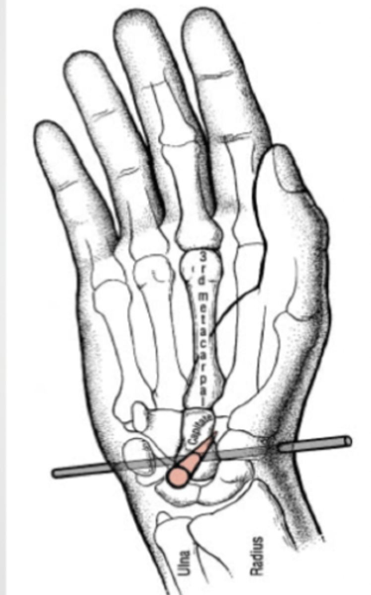 <p>The lunate and capitate bones mark the central axis of the wrist.</p>