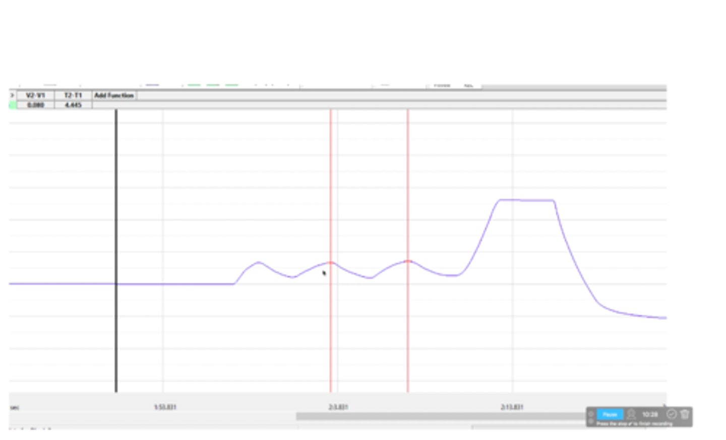 <p>What is depicted on the spirometry tracing?</p>