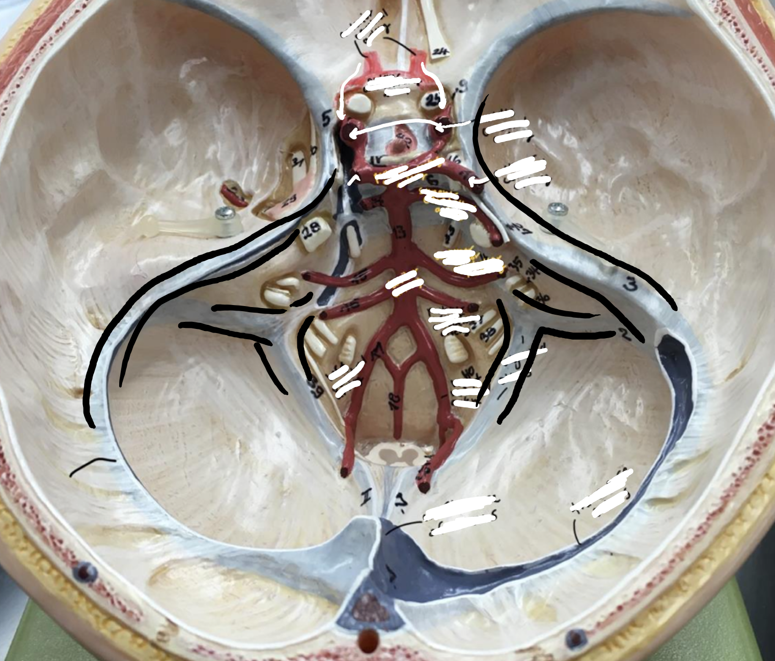 <p>The inner light blue S-shaped curve just below the transverse sinus</p>