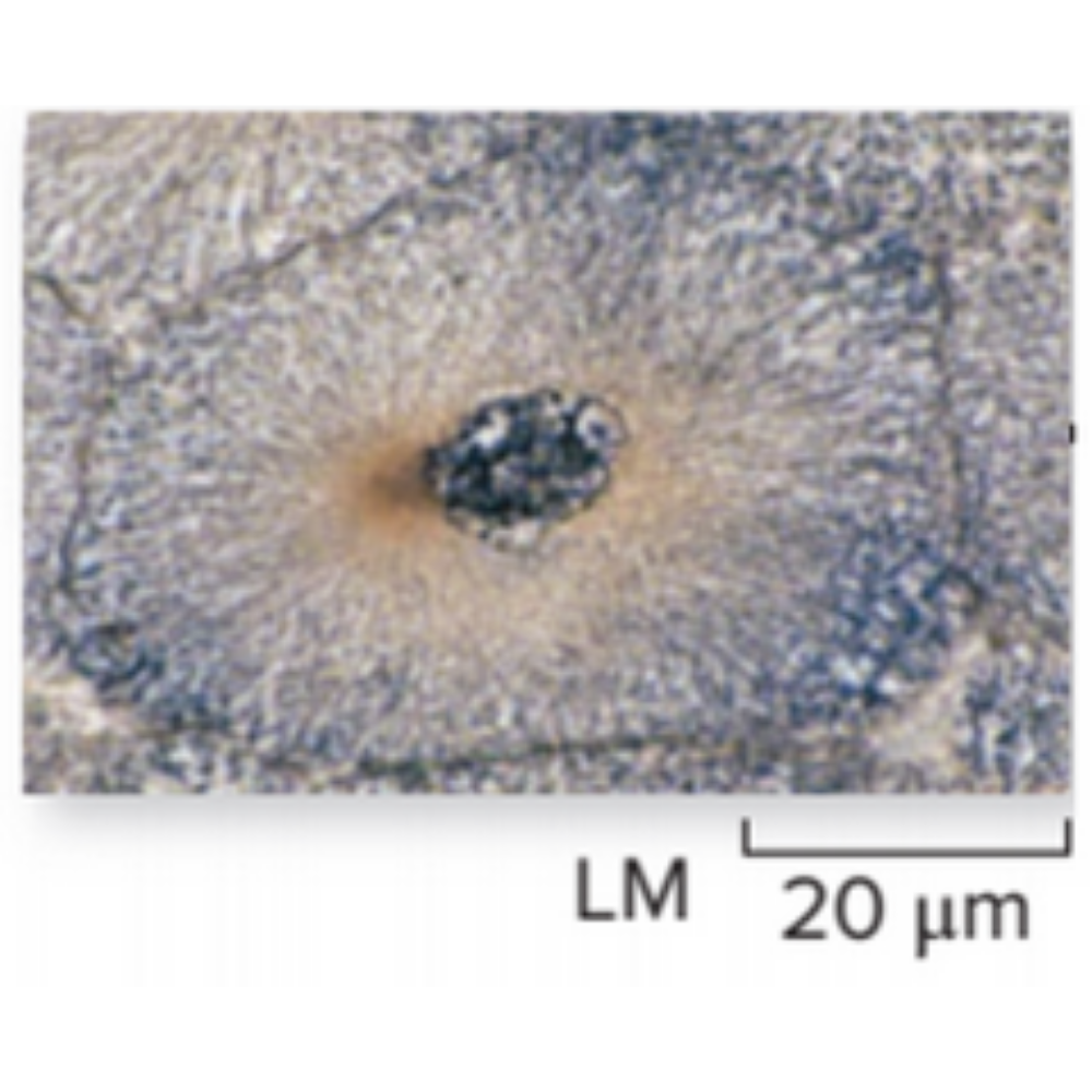 <p>What kind of cell is shown? Name the phase that it is experiencing.</p>