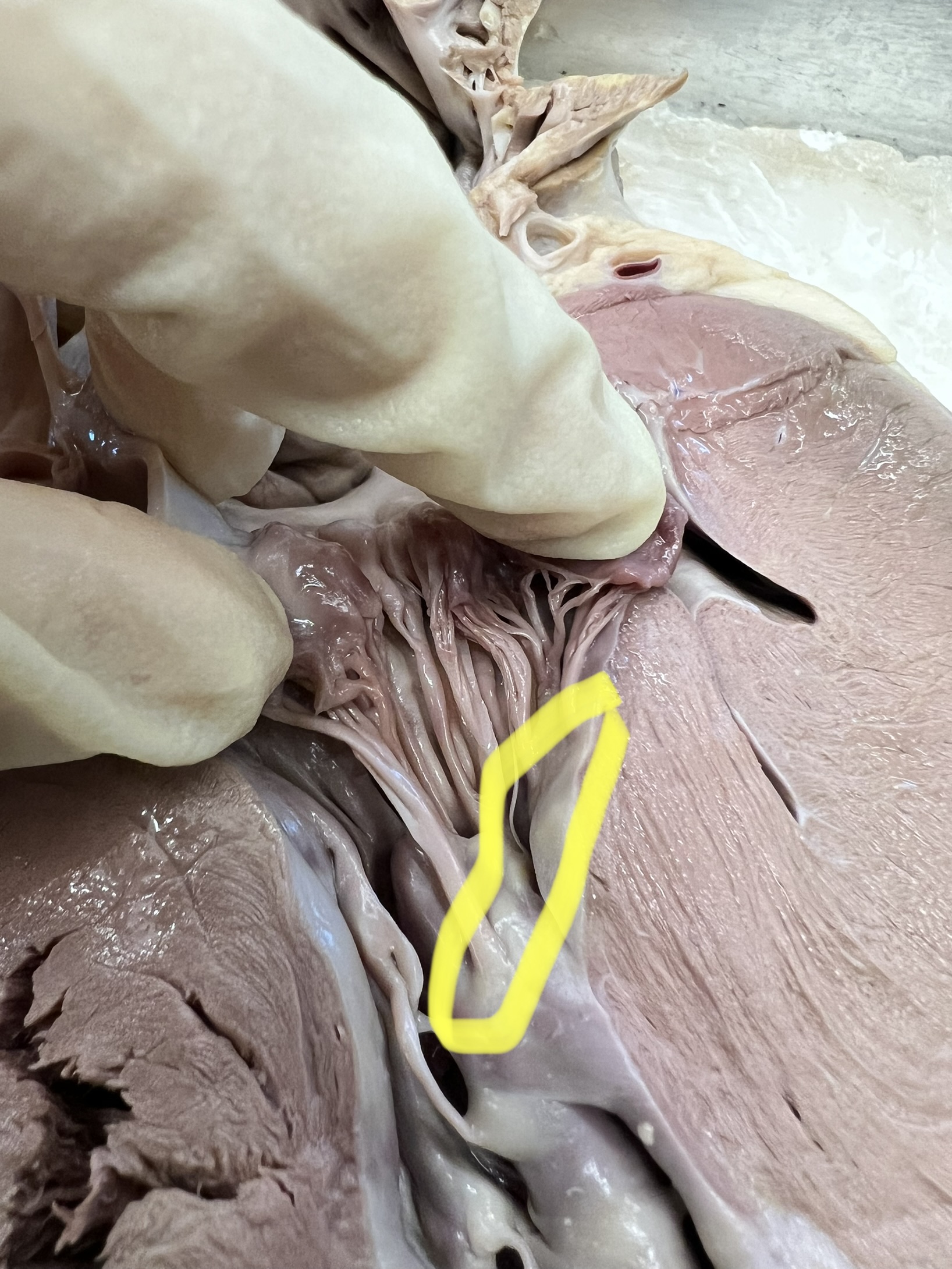 Name the heart structure.