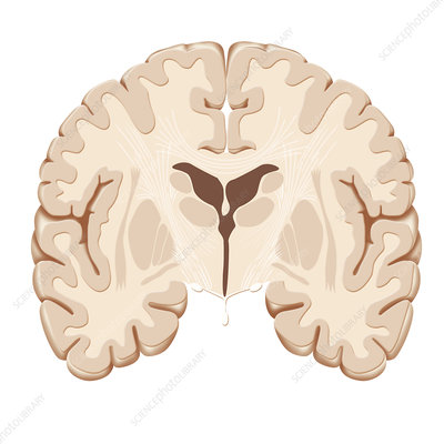What is this plane view of the brain and why? 
