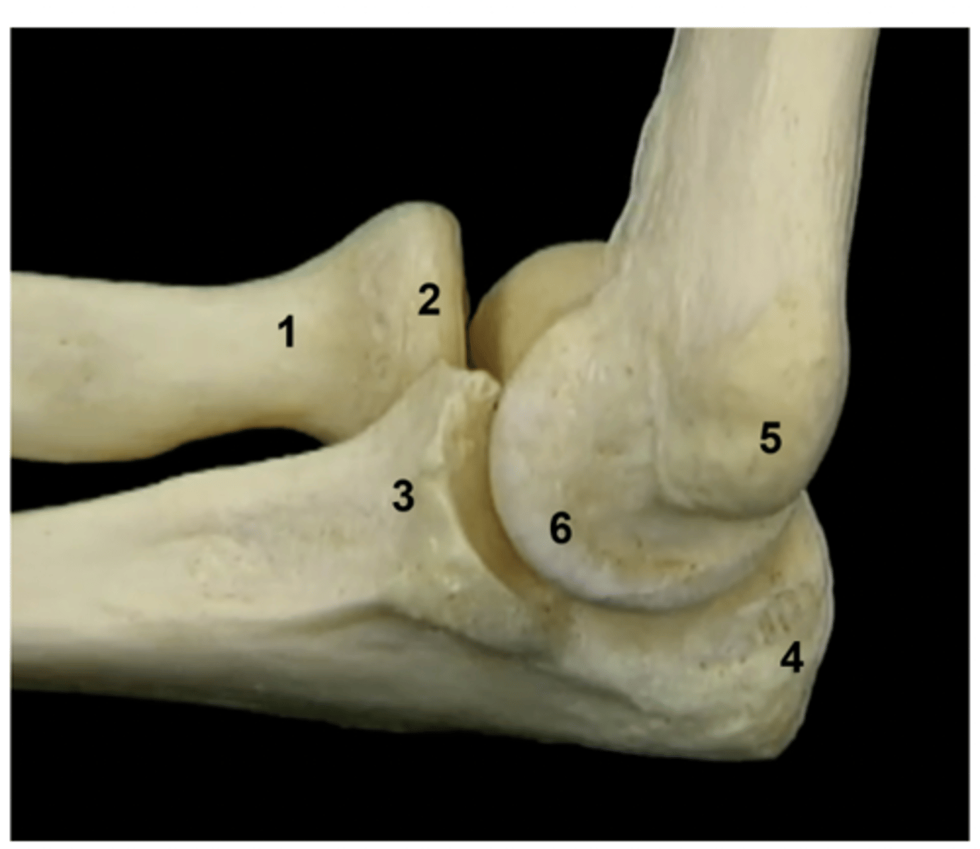 <p>Inverse card: label the image</p><p>1. Neck of radius</p><p>2. Head of radius</p><p>3. Coronoid process</p><p>4. Olecranon</p><p>5. Medial epicondyle of humerus</p><p>6. Trochlea</p>