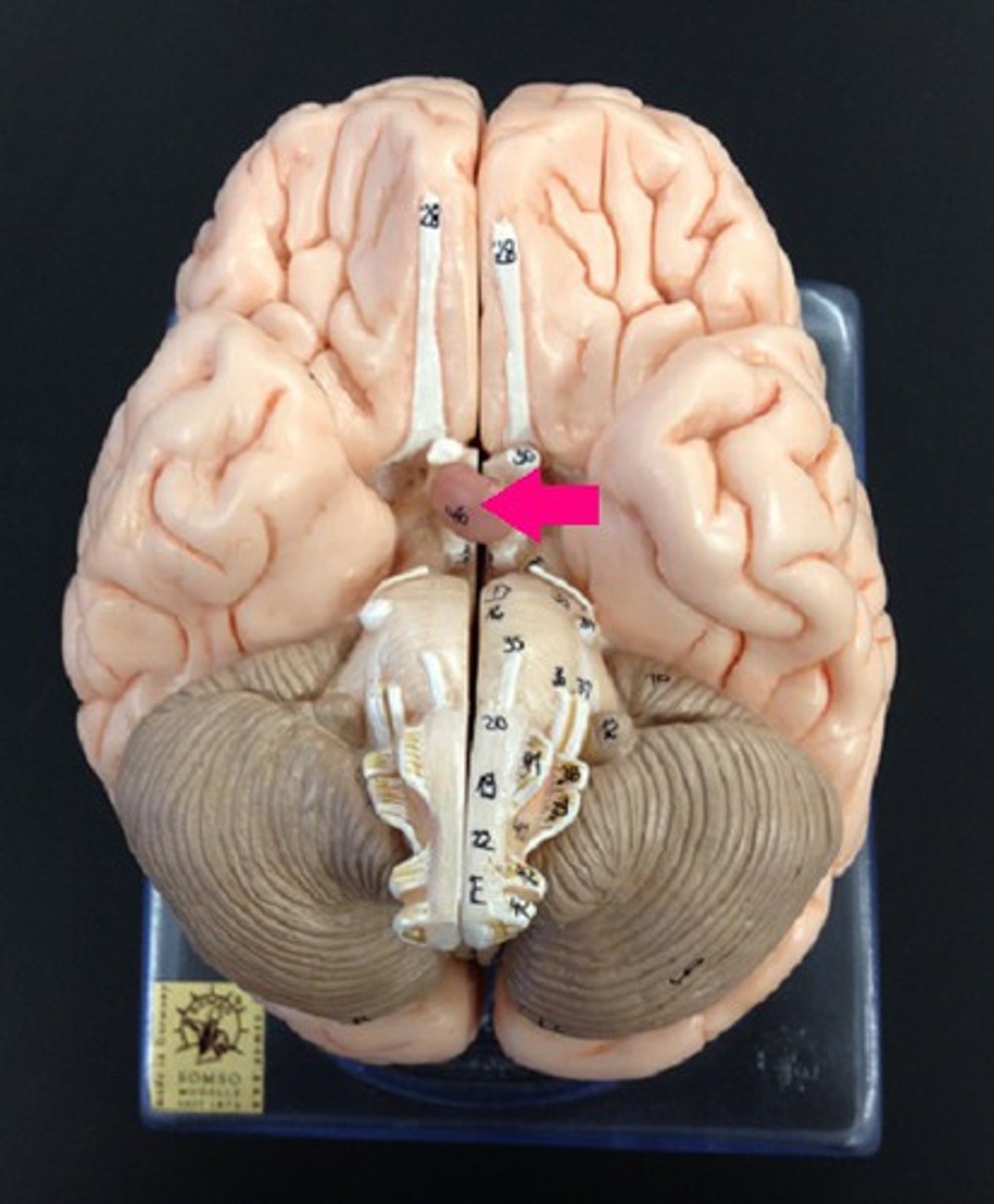 <p>Identify the structure.</p>