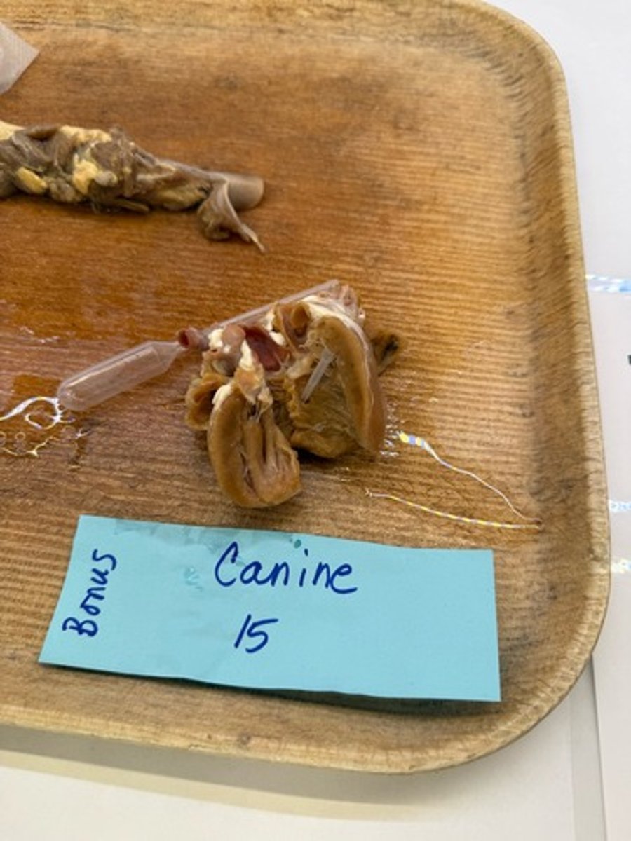 <p>What is this lesion?</p>