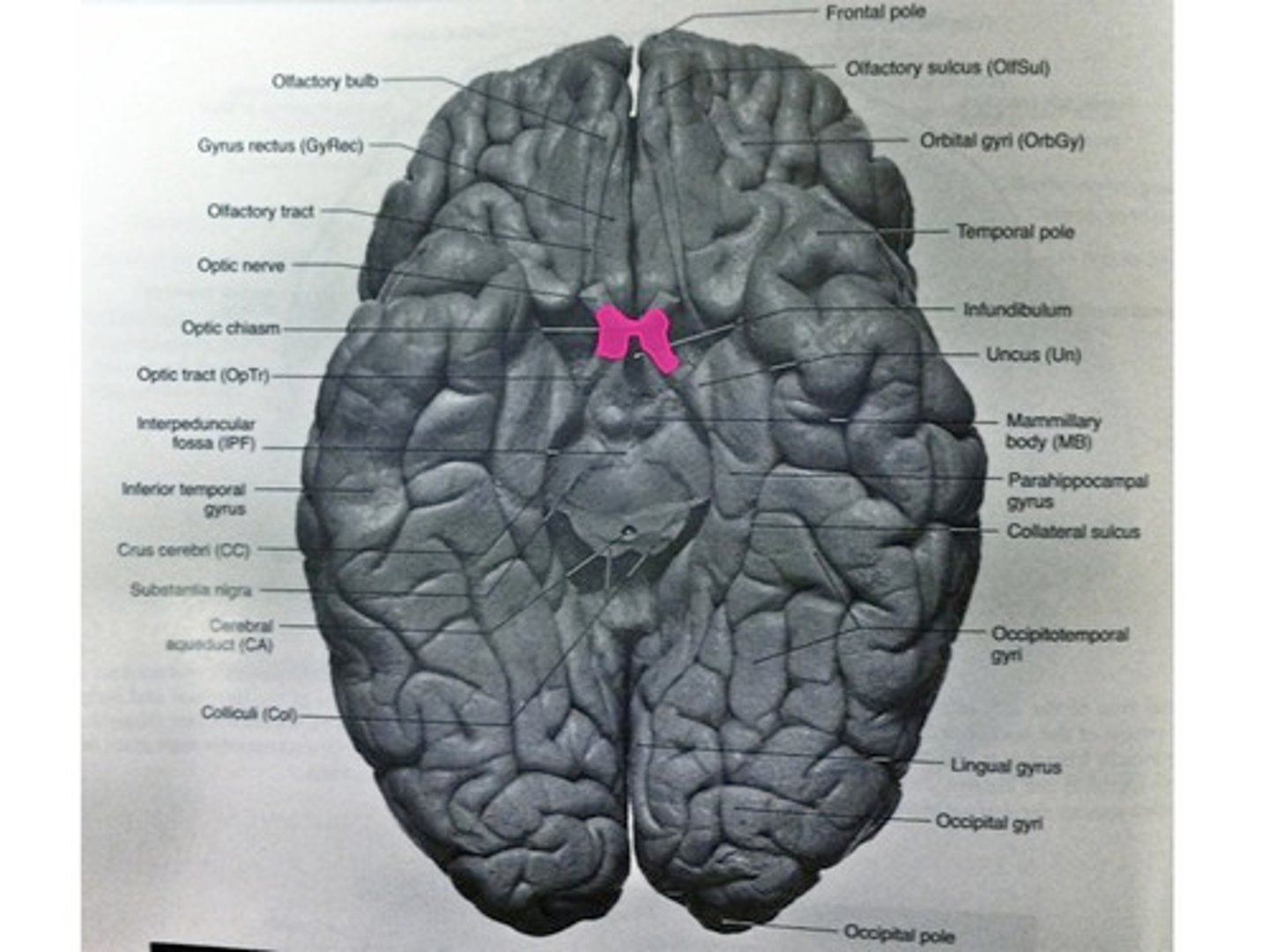 <p>the point in the brain where the visual field information from each eye "crosses over" to the appropriate side of the brain for processing</p>