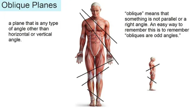 <p>Oblique </p>