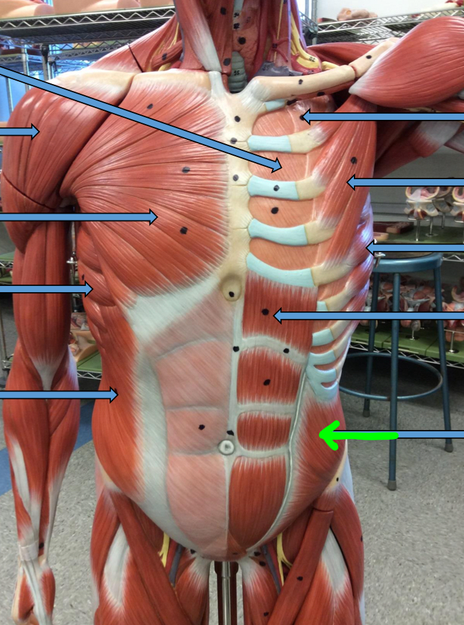 <p>Identify this muscle?</p>