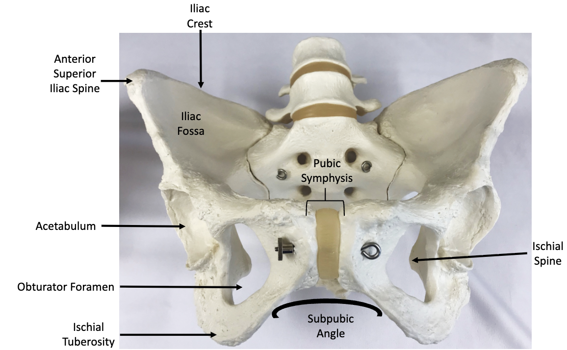 <p>Is this a male or female pelvis?</p>