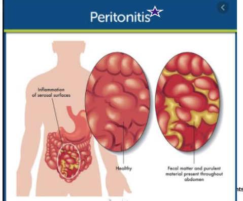<p>IF of serosal surfaces on Intestines</p><p></p>