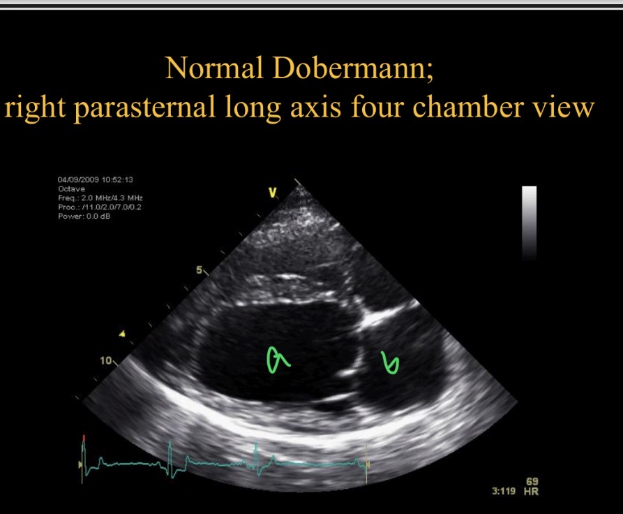 <p>Which chamber is A </p>