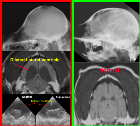 <ul><li><p><strong>Cause:</strong></p><ul><li><p><strong>Overproduction or obstruction to outflow of CSF: choroid plexus</strong></p><ul><li><p>high production, low absorption</p></li></ul></li><li><p><u>Congenital</u> or acquired</p><ul><li><p><strong>Dome head toy breeds</strong></p></li></ul></li></ul></li><li><p><strong>CS:</strong></p><ul><li><p><u>dull</u> mentation, seizures, incoordination</p></li></ul></li><li><p><strong>Views:</strong></p><ul><li><p>Closed mouth VD and lateral</p><ul><li><p><strong><u>5% will show x-ray signs</u></strong></p></li></ul></li></ul></li><li><p><strong>RS:</strong></p><ul><li><p><strong>Open fontanel </strong>and suture, caudal osseous tentorium, <strong>ground glass</strong> look, thin cortex, <strong>dilated lateral ventricles</strong></p><ul><li><p>Adults, may look normal</p></li></ul></li></ul></li></ul><p></p>