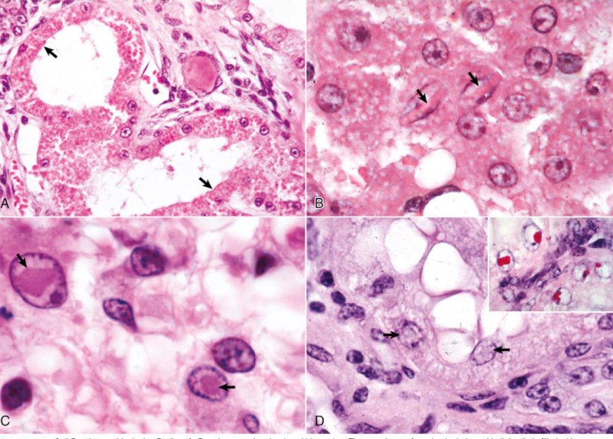 <p>what is being shown in image B**</p>