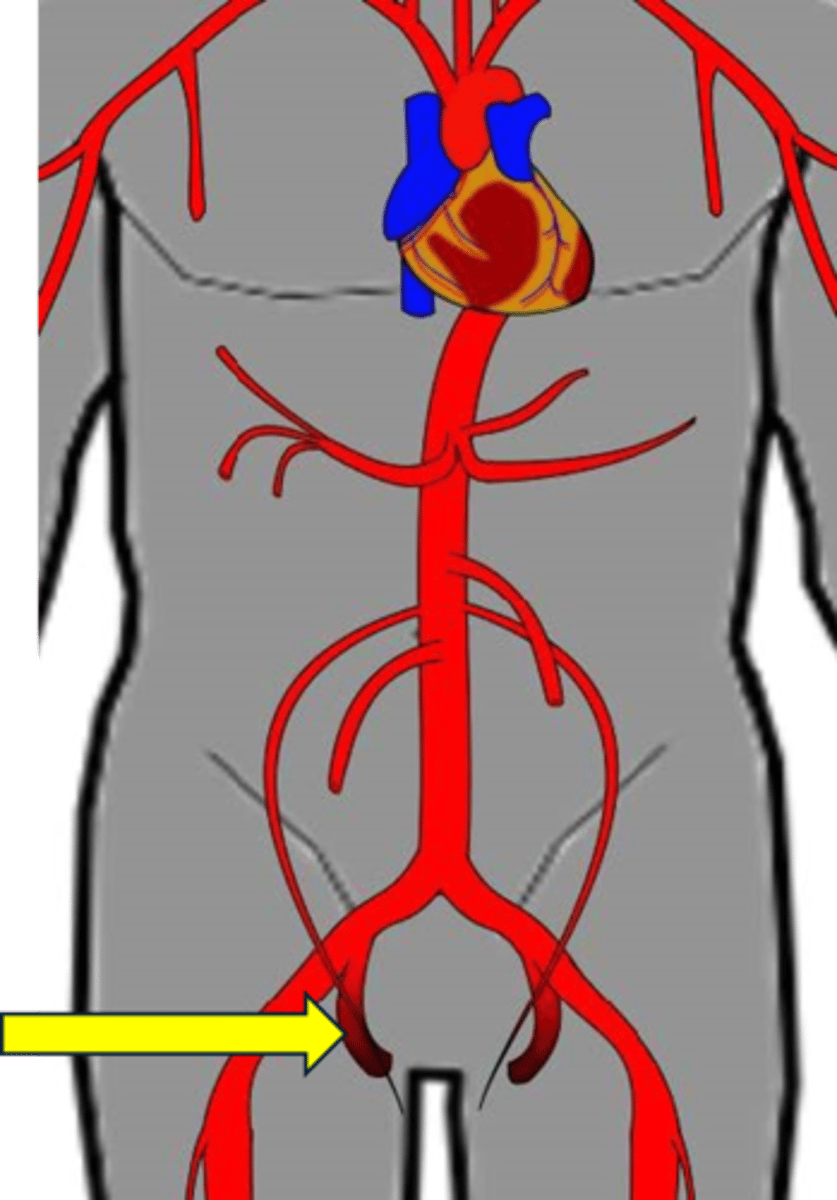 <p>Name the red vessel.</p>