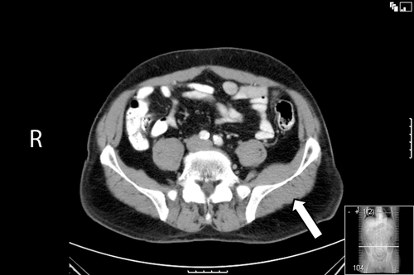 <p>What is indicated in the image?</p>