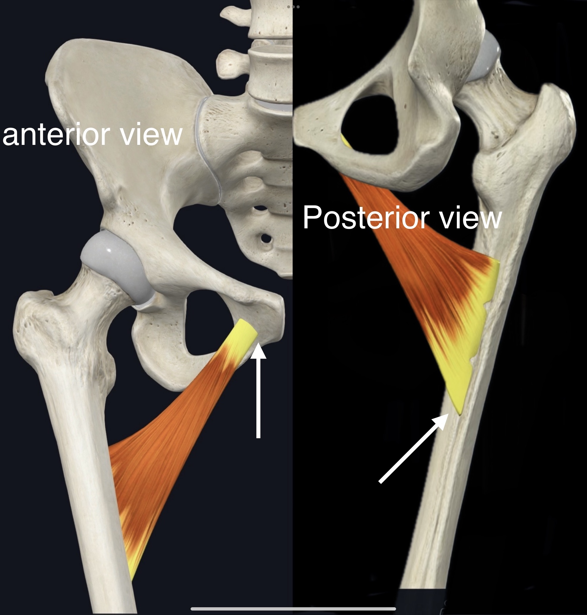 <p>Name the muscle, origin and insertion</p>
