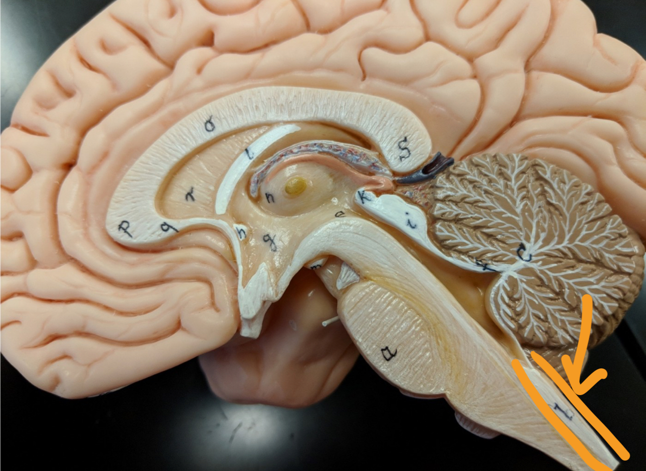 <p><strong>open spaces of the brain + the spine</strong></p><p>what is this?</p>