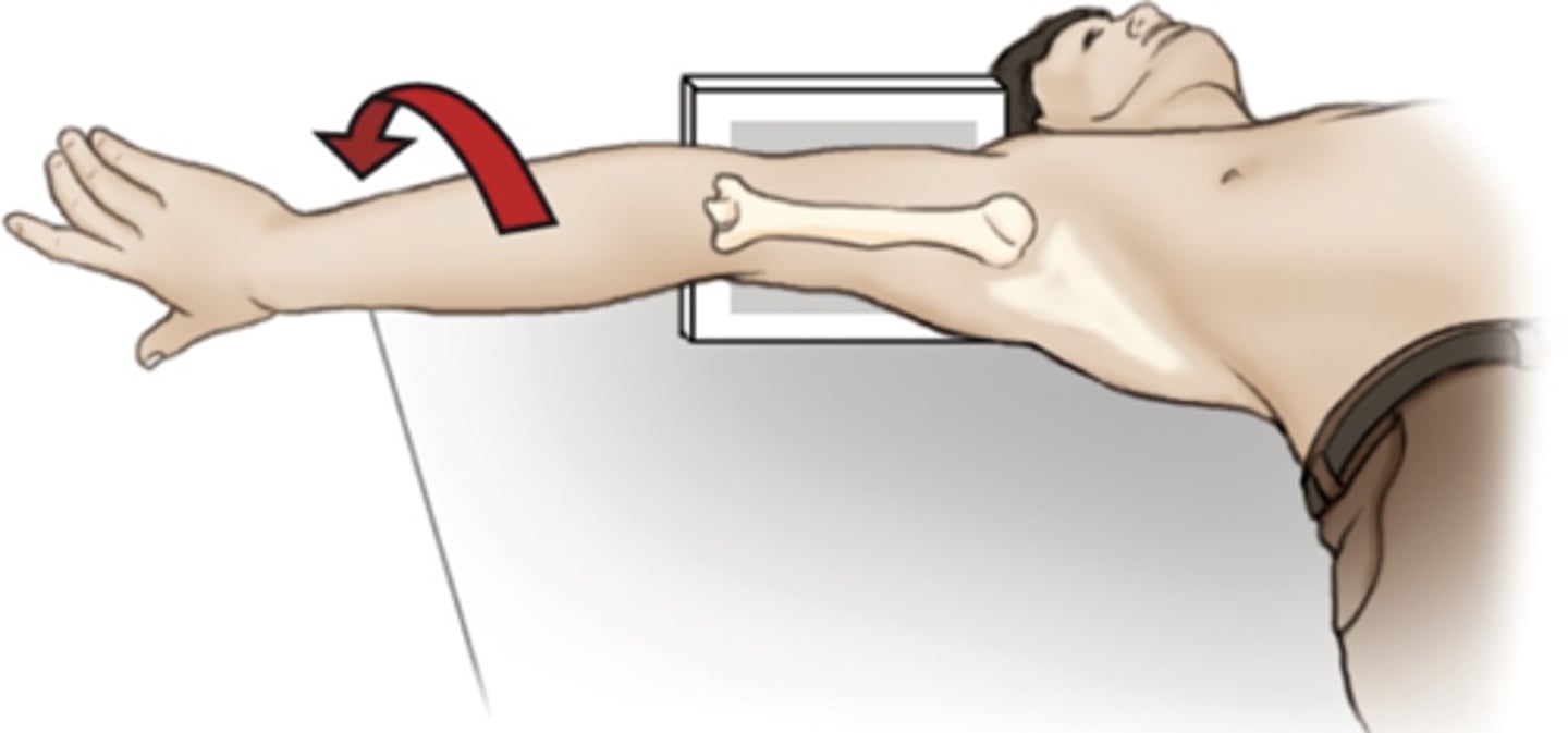 <p>- Demonstrate possible Hill-Sachs defect</p><p>- When there is an anterior dislocation, sometimes it may result in a wedge shape compression fracture on the humeral head.</p>