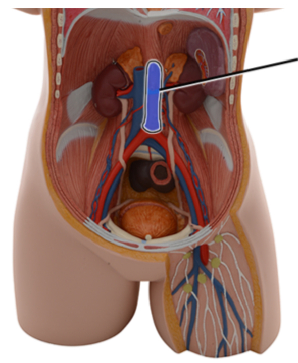 <p><span style="font-family: Arial; font-size: 11px; color: rgb(0, 0, 0);">Name this structure of the heart.</span></p>