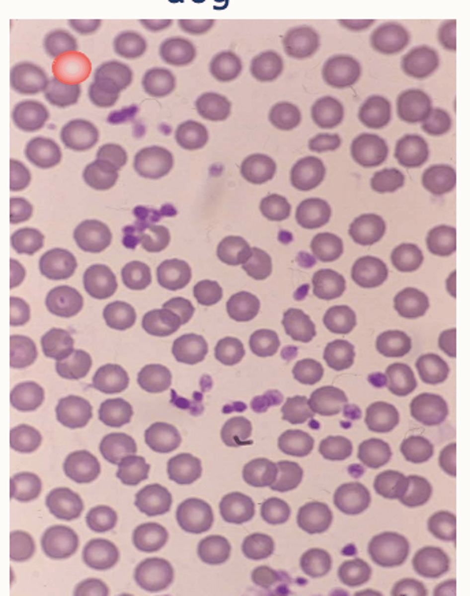 <p>Larger erythrocytes</p><p>Uniform size</p><p>Central pallor</p>