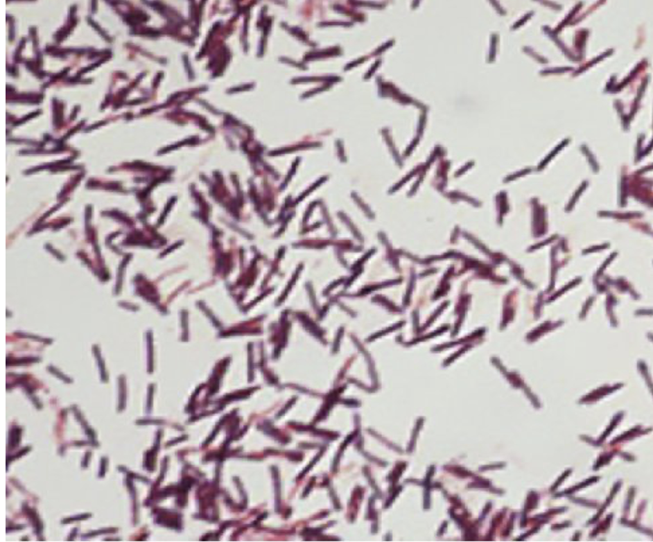 Bacillus cereus (gram stain)