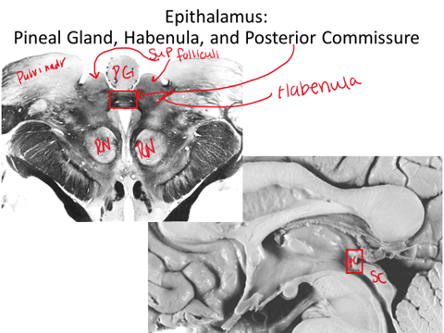 <p>- Pineal gland</p><p>- Habenula</p>