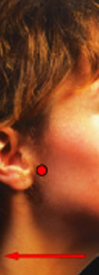 <p>Which special movement is:</p><ul><li><p>Opposite of protraction</p></li><li><p>Moves posteriorly (pulling back)</p></li></ul><p></p>