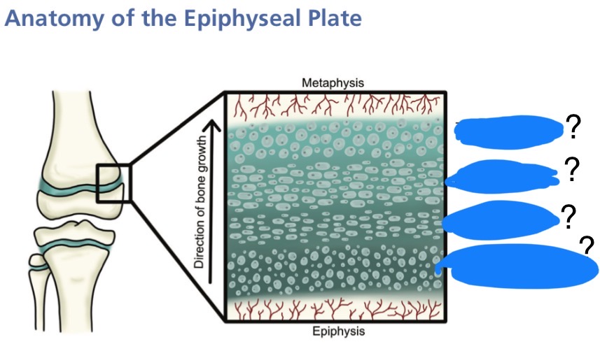 <p>Label the areas of the epiphyseal plate</p>