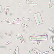 <p><span>This structure is observed in a urine sediment from a dog on 40X. What is the structure?</span></p>