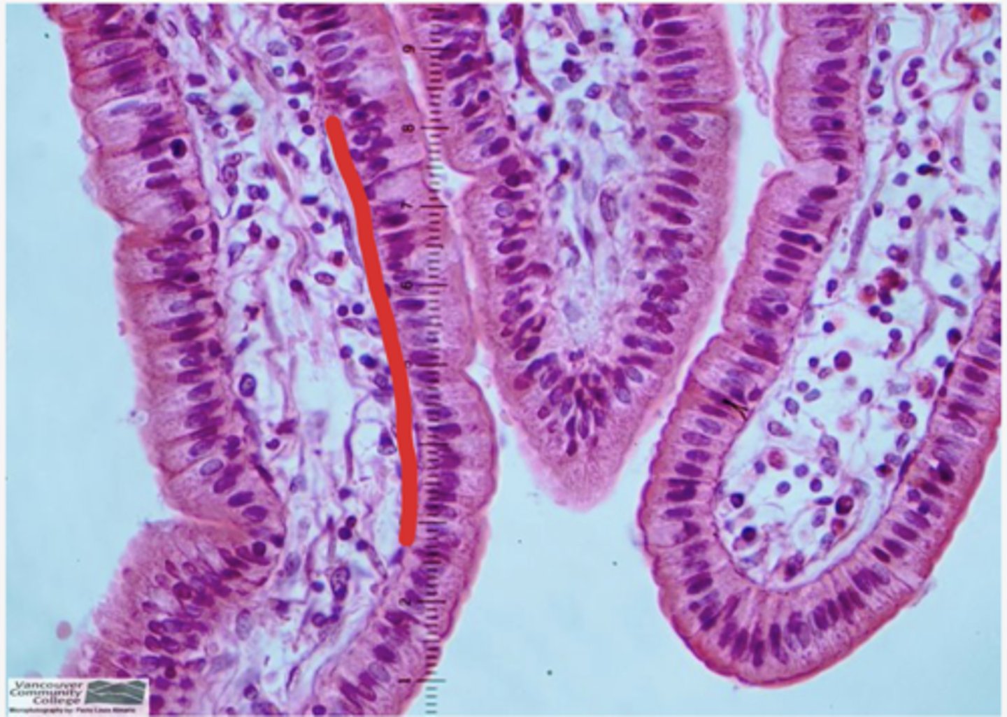<p>Identify the structure in red (in the tagged structure list)</p>