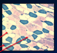 \-manipulate the pH of the cell, so that some of the myosin ATPases are inhibited and others are active, so will be catalyzing reaction that releases Pi 

\-then add a colouring agent reacts to the Pi and turns blue (for example) 

\-so the cells that turn the darkest blue ar ethe most active, so we can figure out which it is depending on the pH we manipulated 

\-the other cells that are not in their optimal pH but still slightly active will have a less intense purple colour
