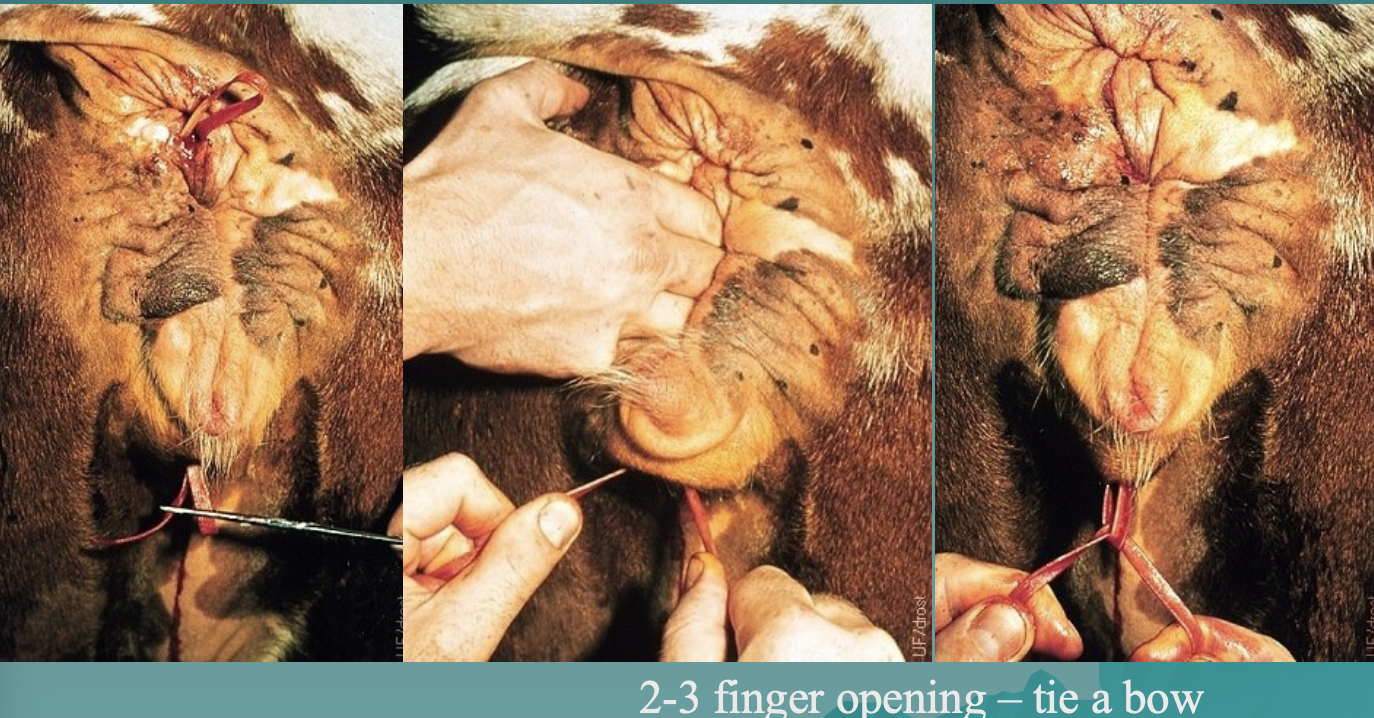 <p>what is this fixation method?</p>