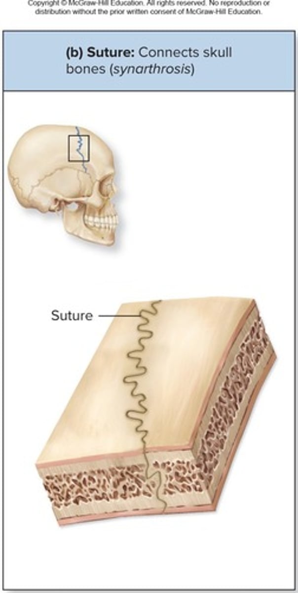 <p>Rigid, interlocking joints that are immovable for protection of the brain</p>