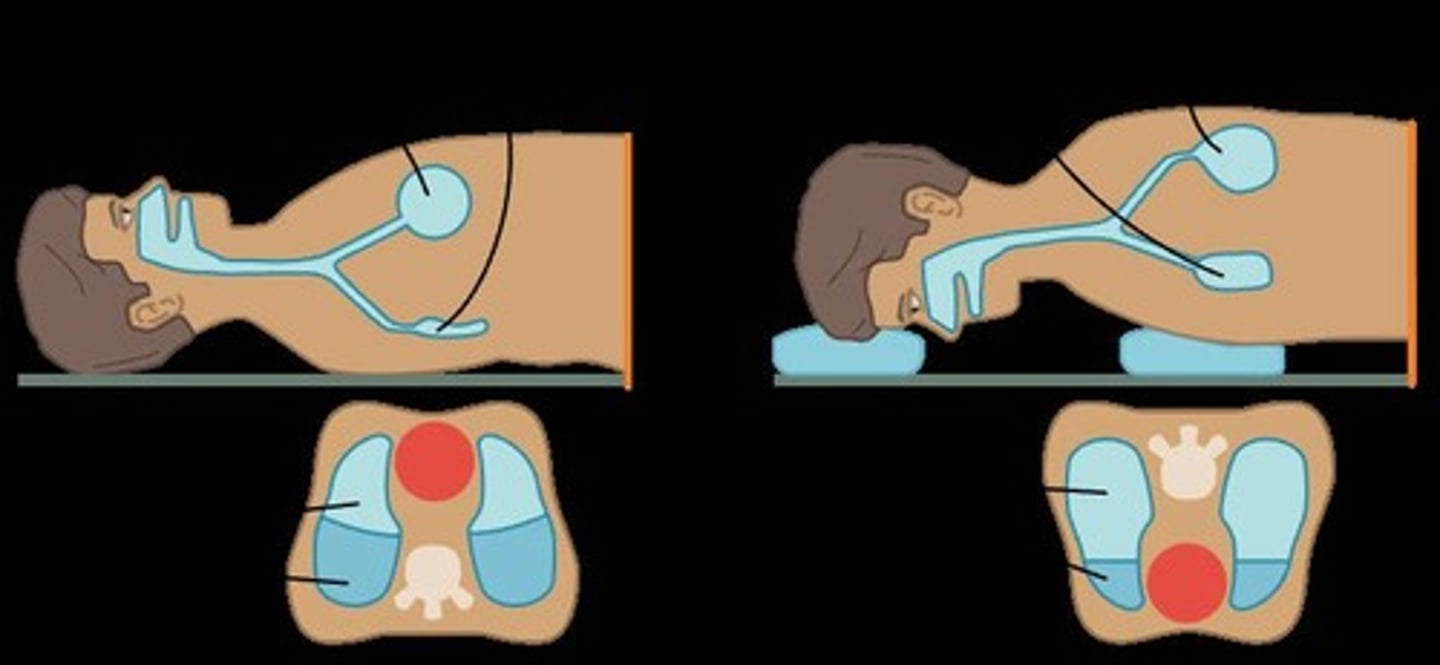 <p>To improve oxygenation and lung mechanics.</p>