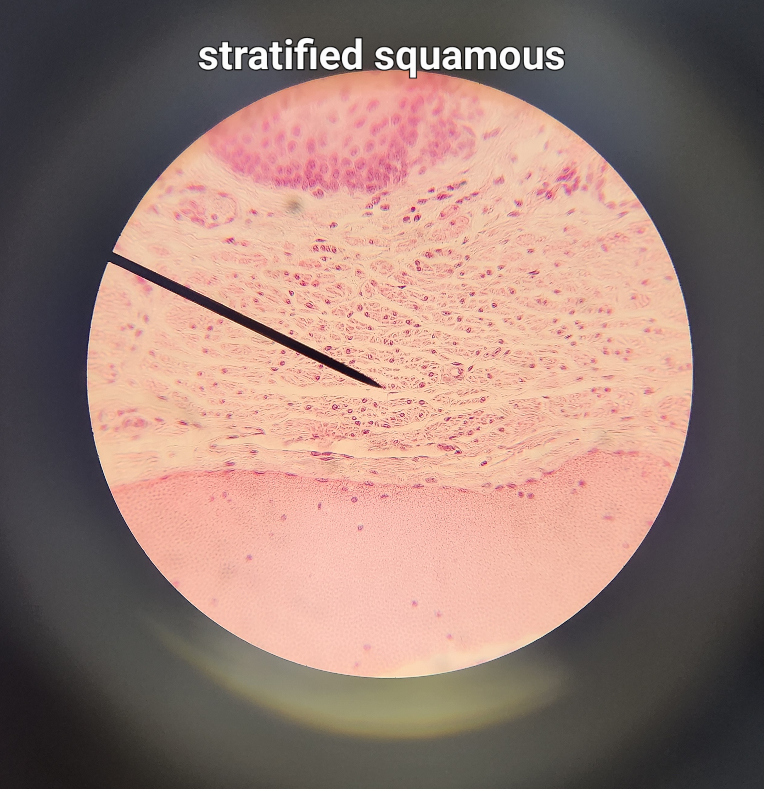 many layers of flat cells (most common)